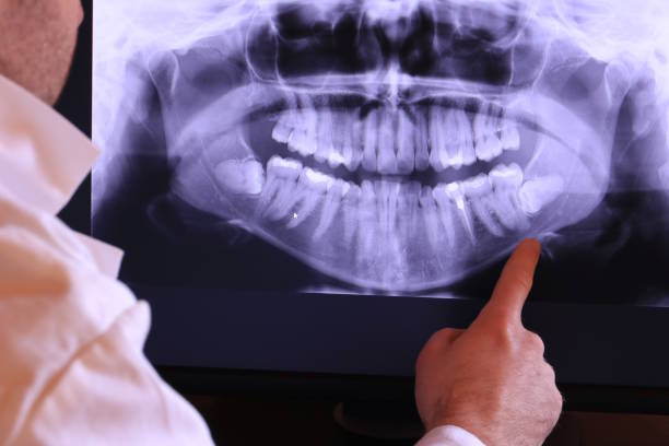 Best Cosmetic Emergency Dentistry in High Ridge, MO